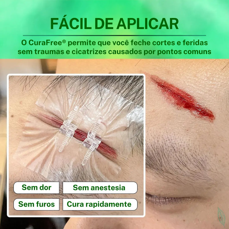 Curativo Para Fechamento de Feridas Ponto Falso CuraFree® (COMPRE 1 LEVE 2)